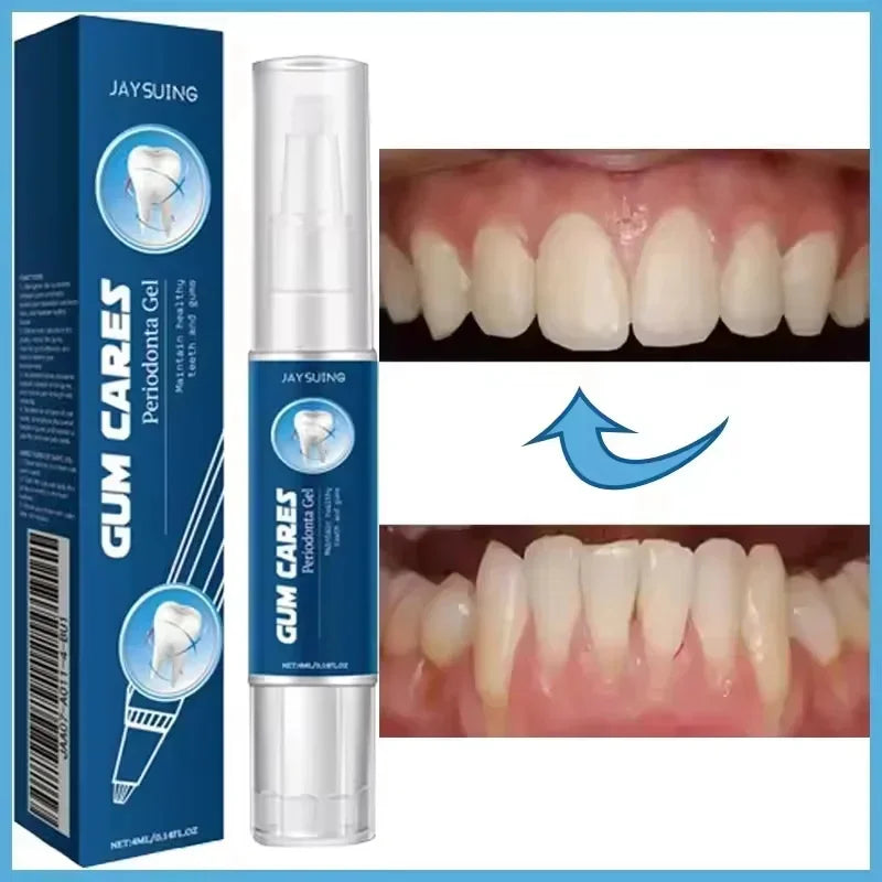 Gum Repair Care Gel | Sore Gums Relief & Deep Teeth Cleaning Serum for Stains, Tartar & Dental Health