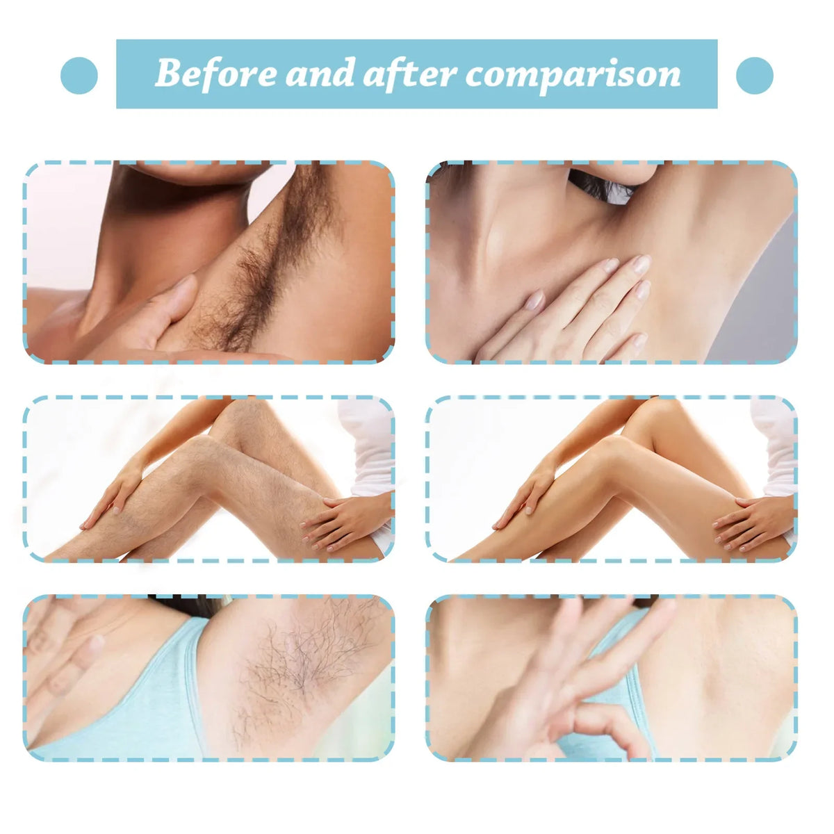 20ml Hair Removal Spray - Depilatory Solution for Body, Underarms, and Intimate Areas
