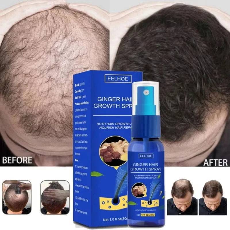 Ginger Hair Growth Serum Spray - Moisturizing Scalp Care and Nourishing Hair Treatment for Men and Women