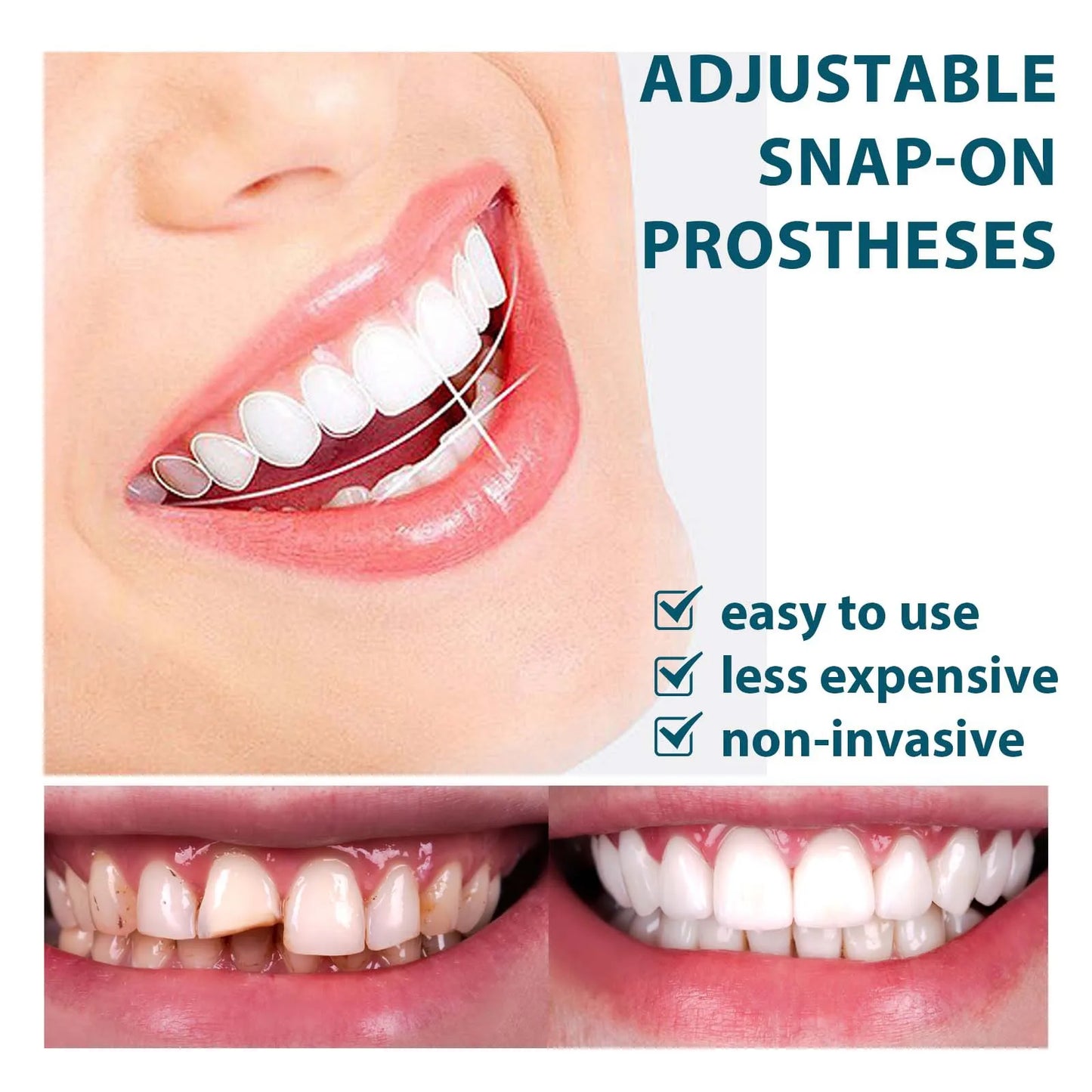 Teeth Veneers & Whitening Denture Kit – Temporary False Teeth Cover for Comfortable, Perfect Smile
