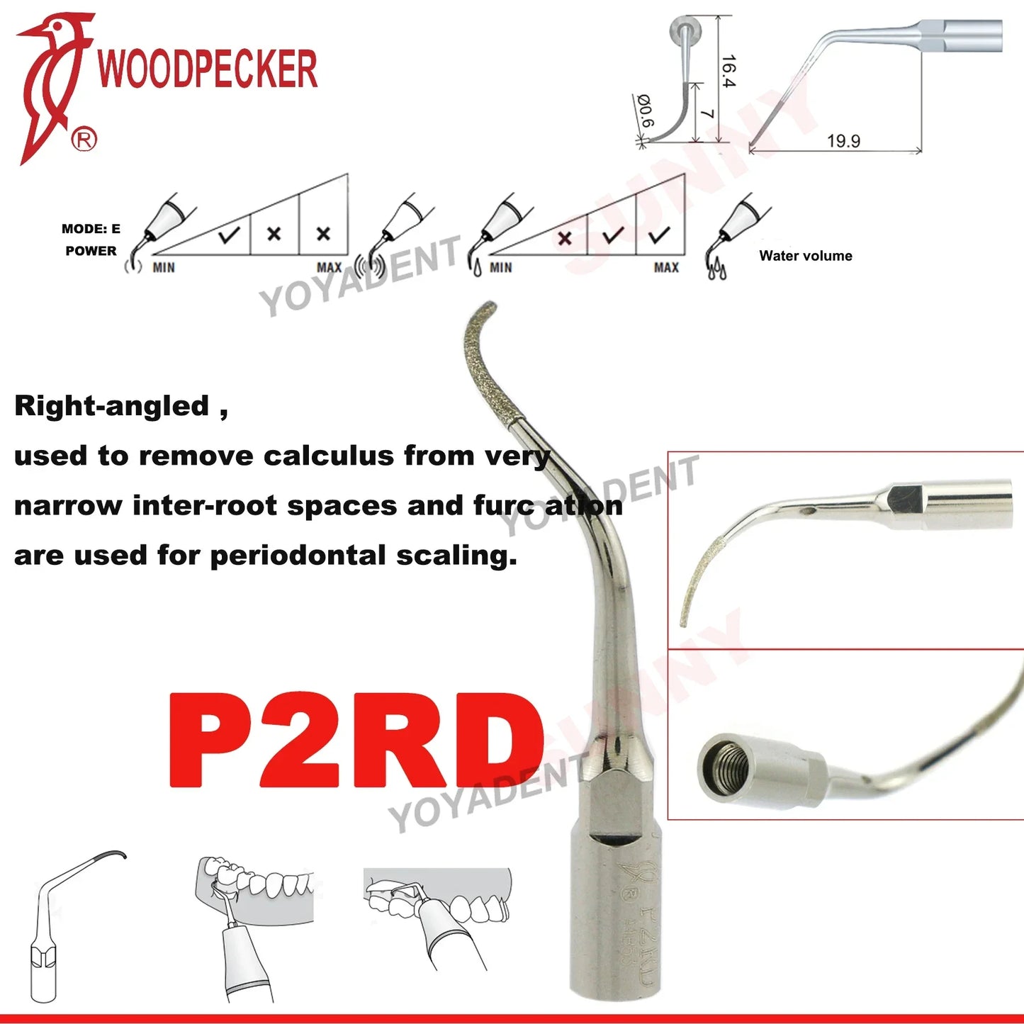 Woodpecker Dental Scaler Tips – Ultrasonic Tooth Cleaning, Endo & Perio Scaling Tips, Fit EMS UDS Scaler Handpiece