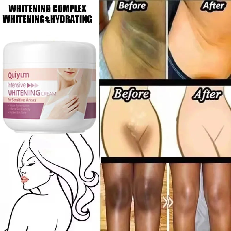 Underarm & Intimate Area Brightening Cream - Moisturizing Korean-Inspired Skincare for Uneven-Looking Skin Tone