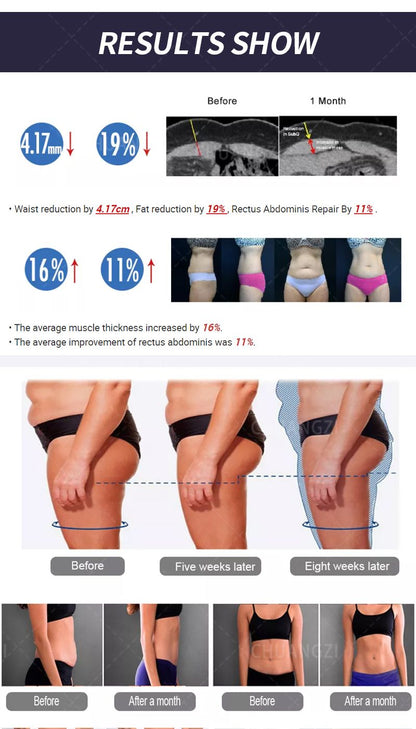 EMSzero 15Tesla 6500W NEO Muscle Sculpting Machine - Electromagnetic Fat Burning and Body Slimming Therapy