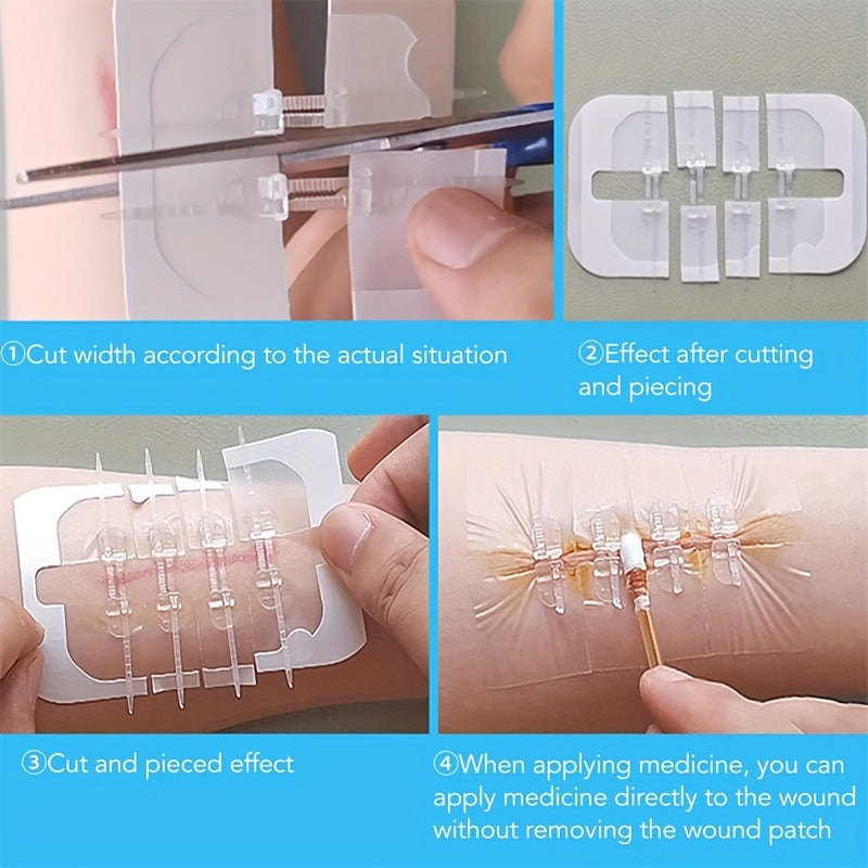 10PCS Elastic Bandage and Skin Suture Device - Scar-Free Zipper Style Wound Patch - Color Box Packaging