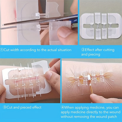 10PCS Elastic Bandage and Skin Suture Device - Scar-Free Zipper Style Wound Patch - Color Box Packaging