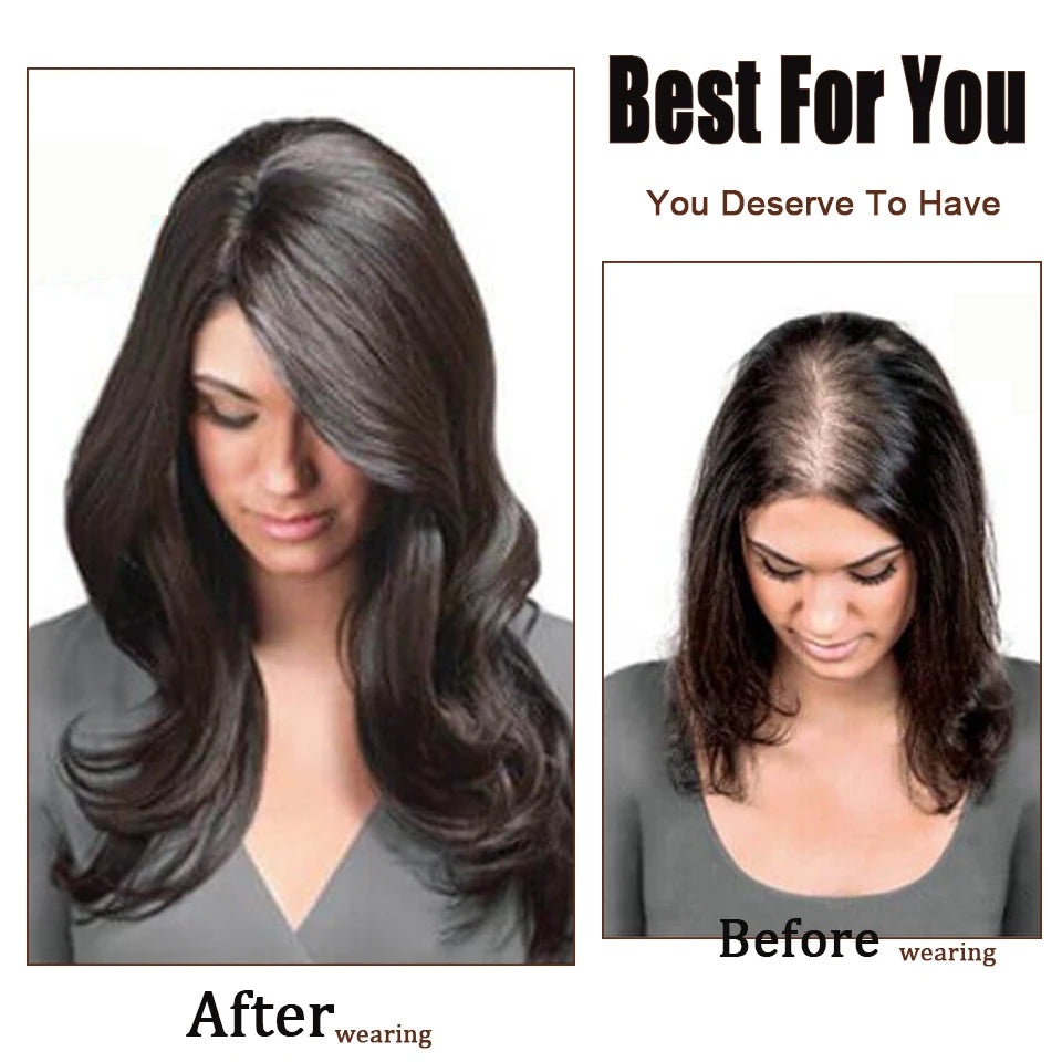Dazzeal Human Hair Topper – 100% Real Straight Hair, Lace Base, Clip-In with Bangs, 10x12cm, 360° Coverage