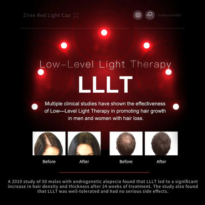 Laser Hair Growth Cap – 94/128/208 Laser Irradiation for Rapid Hair Growth & Oil Control, Remarkable Results