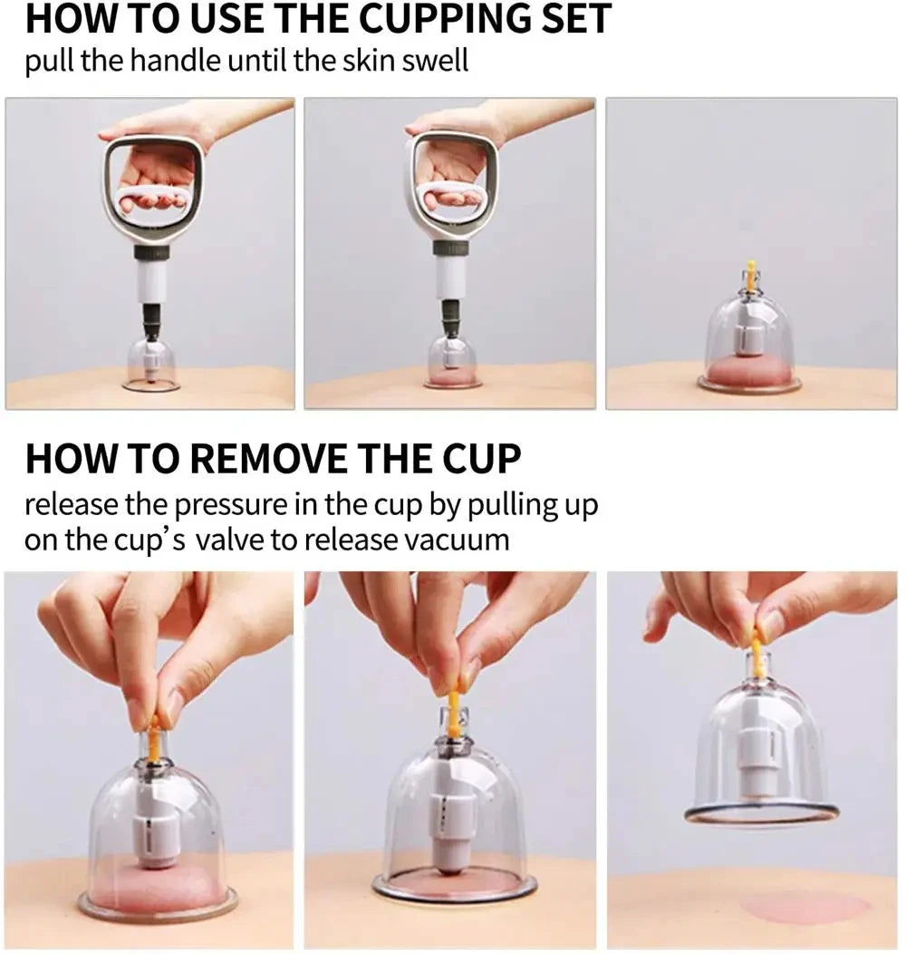 Cupping Therapy Set — Vacuum Suction Cups for Massage, Anti-Cellulite & Physiotherapy Body Treatment
