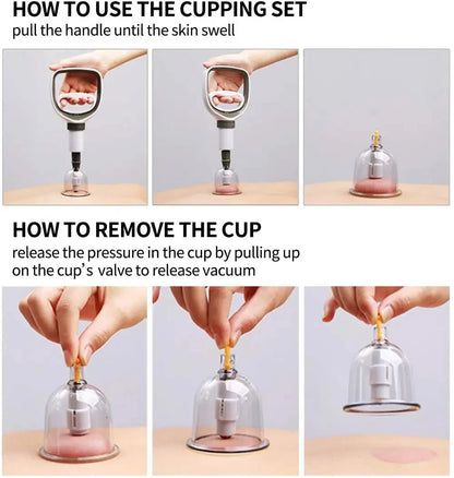 Cupping Therapy Set — Vacuum Suction Cups for Massage, Anti-Cellulite & Physiotherapy Body Treatment