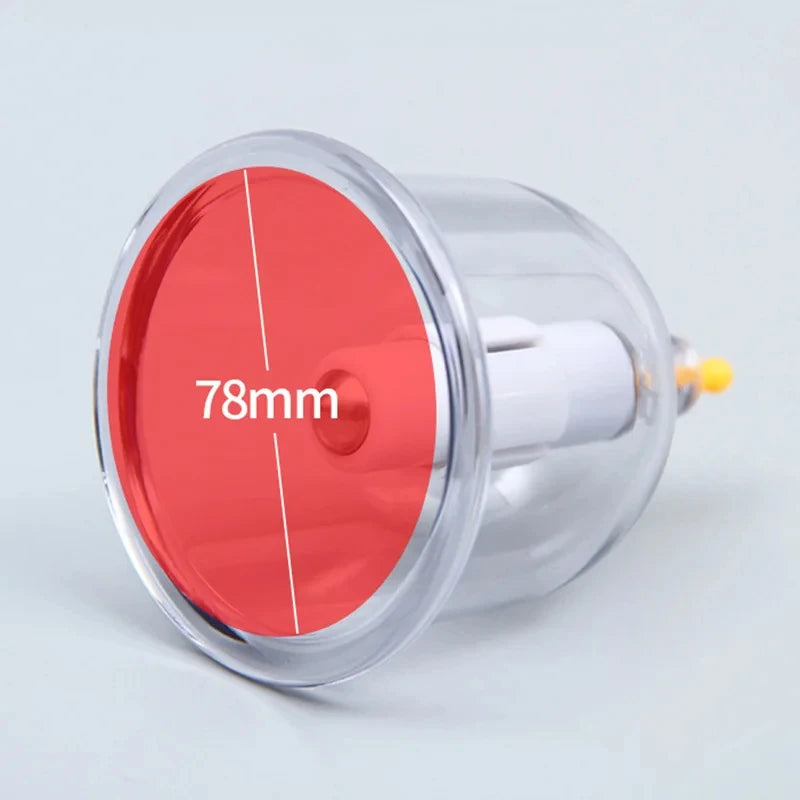 Cupping Therapy Set — Vacuum Suction Cups for Massage, Anti-Cellulite & Physiotherapy Body Treatment