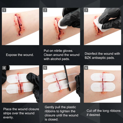 RHINO RESCUE Zip Stitch Laceration Closure Kit — Wound Closure Strips with Dressings, Suture-Free Care