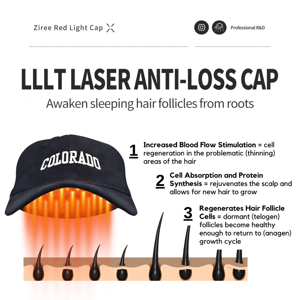 Laser Hair Growth Cap – 94/128/208 Laser Irradiation for Rapid Hair Growth & Oil Control, Remarkable Results