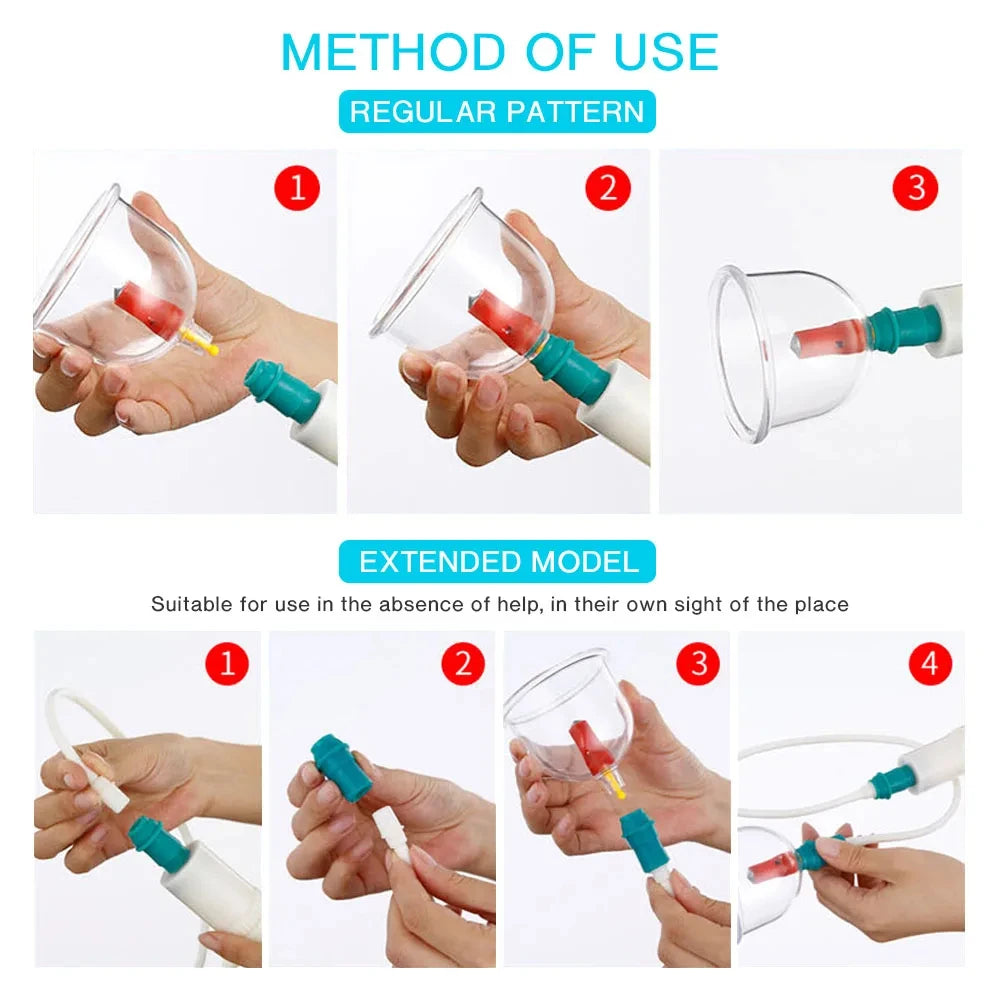 Cupping Therapy Set — Vacuum Suction Cups for Massage, Anti-Cellulite & Physiotherapy Body Treatment