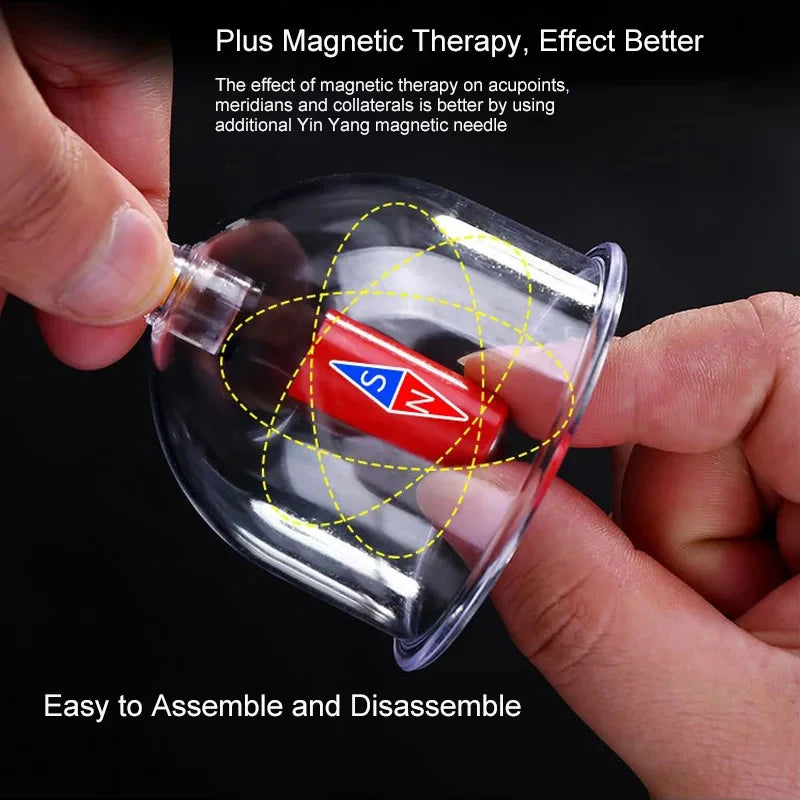 Cupping Therapy Set — Vacuum Suction Cups for Massage, Anti-Cellulite & Physiotherapy Body Treatment