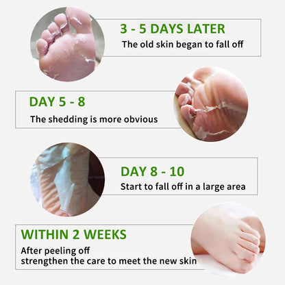 FlowWeek Exfoliating Foot Mask – Removes Dead Skin, Calluses & Dry, Chapped Feet for Smooth, Soft Skin