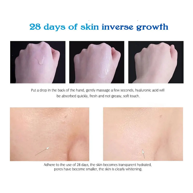 ARTISCARE Hyaluronic Acid Serum & VC Essence Cream - 10PCS Moisturizing Facial Care for Acne, Aging & Wrinkle Care