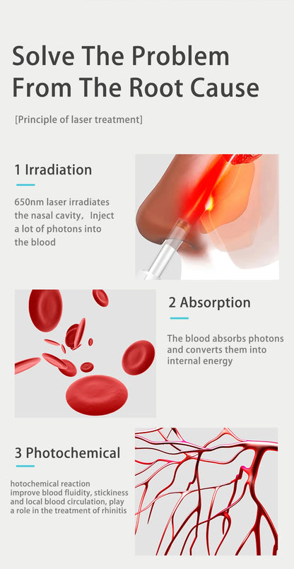Tinnitus Ear Laser Therapy – 650nm Irradiation Physiotherapy Earplug for Otitis Media & Deafness Treatment, USB Interface