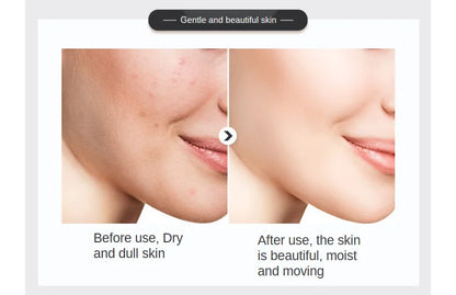 500ml Hyaluronic Acid Facial Essence – Moisturizing, Whitening, Pore Minimizing, Anti-Aging & Anti-Wrinkle Serum with VC & Niacinamide