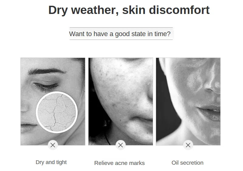 500ml Hyaluronic Acid Facial Essence – Moisturizing, Whitening, Pore Minimizing, Anti-Aging & Anti-Wrinkle Serum with VC & Niacinamide