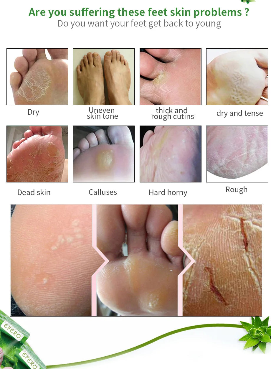 Aloe Vera Foot Mask & Peeling Socks – Exfoliating Scrub for Legs & Feet, Anti-Crack Heel Treatment, Pedicure Skin Removal Patch