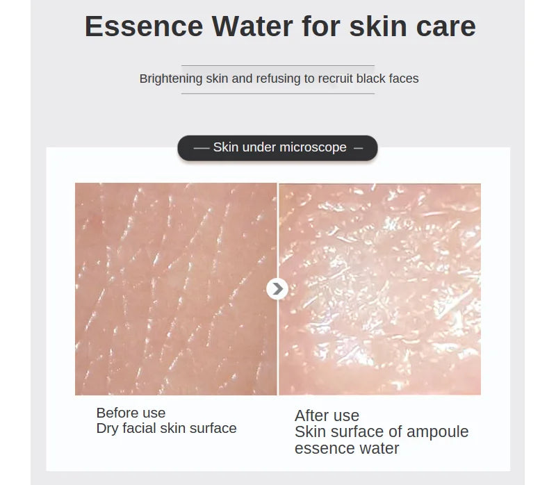 500ml Hyaluronic Acid Facial Essence – Moisturizing, Whitening, Pore Minimizing, Anti-Aging & Anti-Wrinkle Serum with VC & Niacinamide