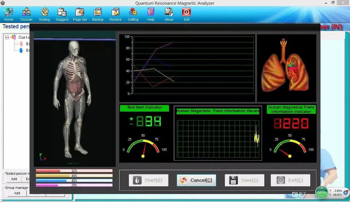 62-Report Quantum Magnetic Resonance Analyzer - Touchscreen Full-Body Analysis Machine with FIR Technology