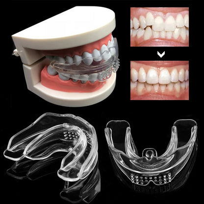 4D Orthodontic Dental Braces – Silicone Teeth Alignment Trainer, Retainer & Mouth Guard for Bruxism