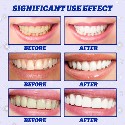 5D Whitening Teeth Stickers – 7/14 Pairs Gel Strips for Stain Removal, Dental Bleaching & Oral Hygiene Care