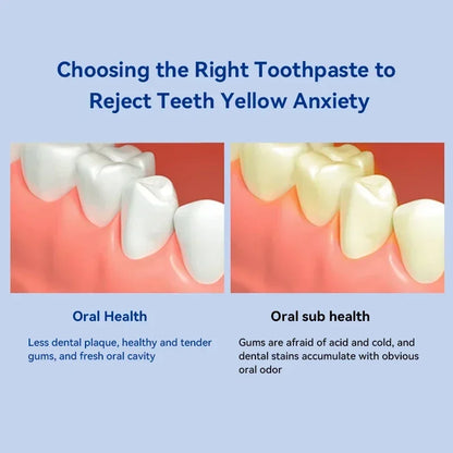 Dental Calculus Remover Toothpaste – Whitening, Bad Breath Removal & Periodontitis Prevention for Teeth Car