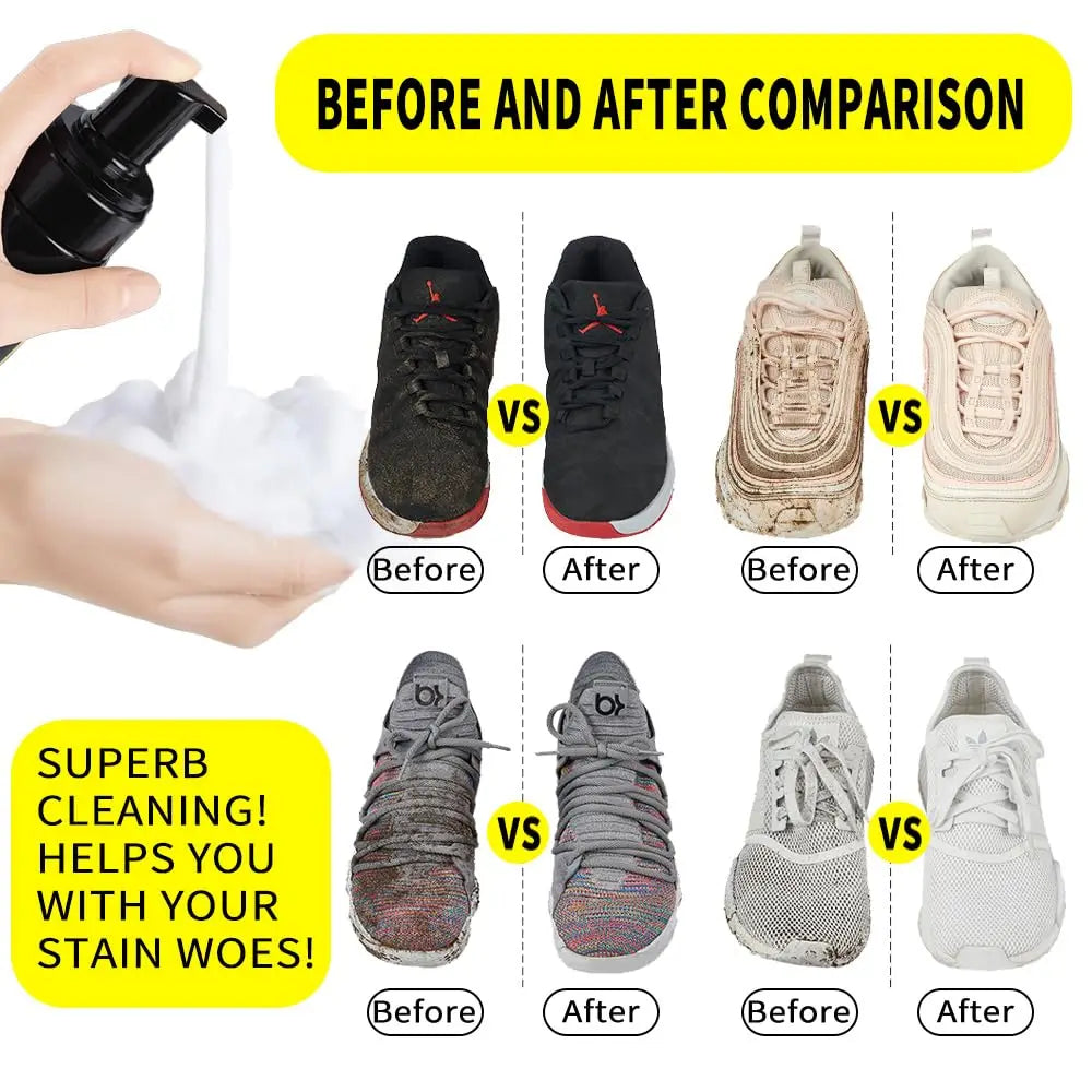 Sneaker Shoe Cleaner Kit — 5.3oz Water-Free Foam with Brush & Cloth, Cleans White Shoes, Suede, Boots