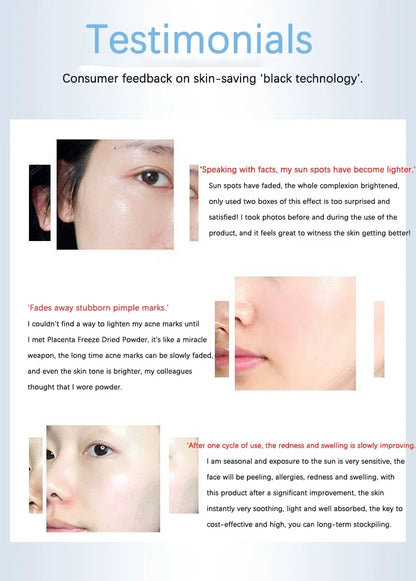 Placenta Freeze-Dried Powder Essence — Hydrating, Nourishing & Skin Rejuvenation Serum for Pore Shrinking