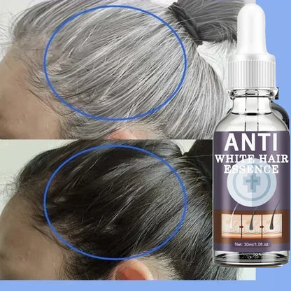 White Hair Remover – Restore Natural Hair Color in 7 Days, Gray Hair Treatment Solution