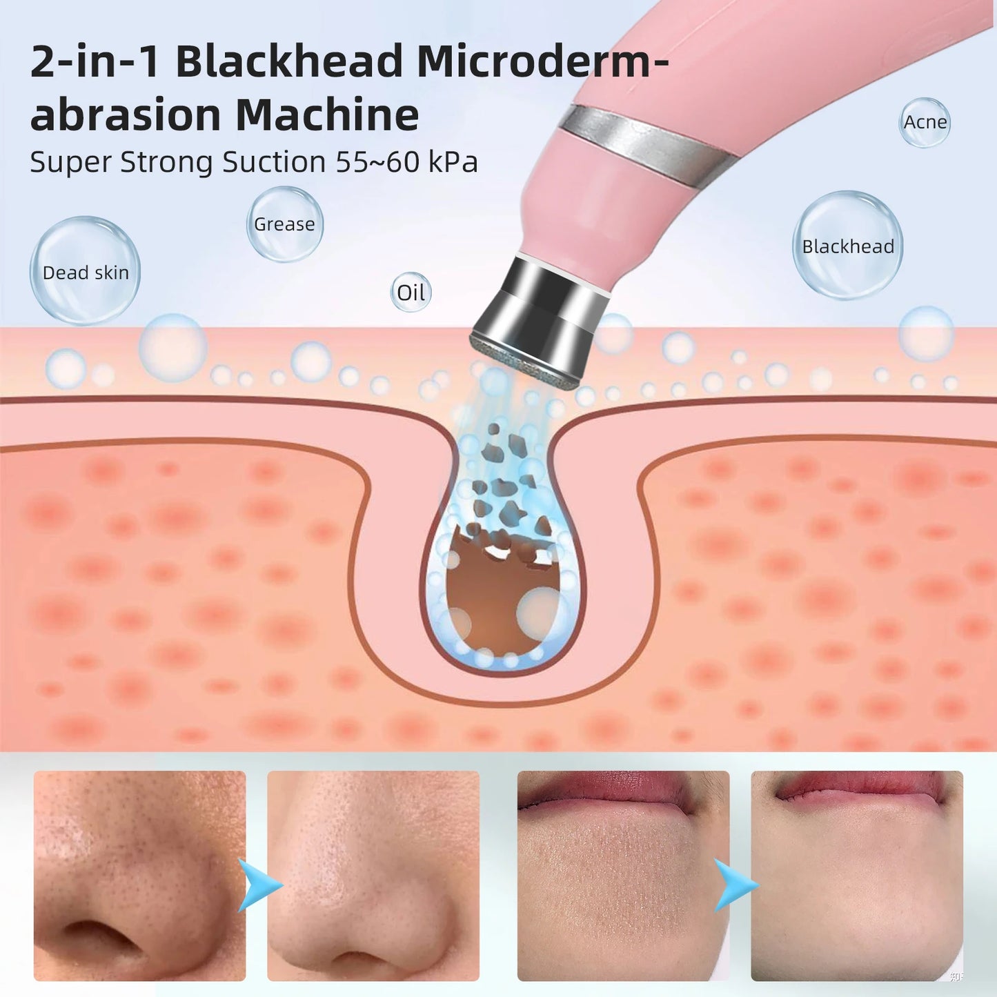 Professional Diamond Microdermabrasion Machine – At-Home Facial Peeling & Deep Cleaning Skin Care Tool