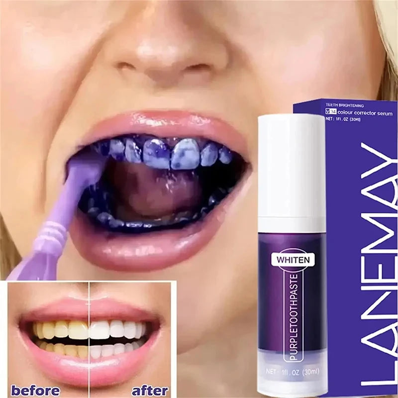 V34 Teeth Whitening Toothpaste – 5D Whitening Stick for Oral Hygiene, Cleaning & Fresh Breath Care