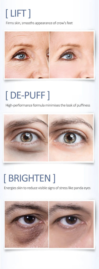 Micro-Needle Hyaluronic Acid Eye Patch – Anti-Wrinkle Moisturizing Eye Mask for Fine Lines Removal