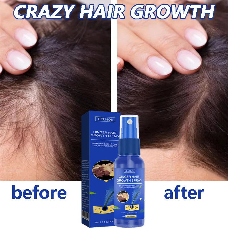 Ginger Hair Growth Serum Spray - Moisturizing Scalp Care and Nourishing Hair Treatment for Men and Women