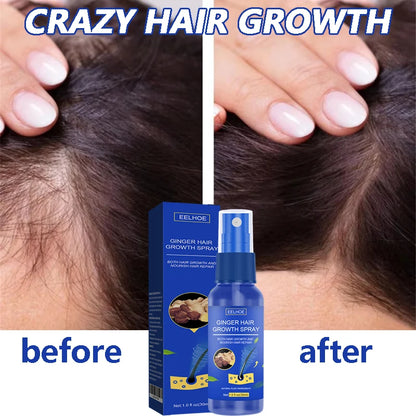Ginger Hair Growth Serum Spray - Moisturizing Scalp Care and Nourishing Hair Treatment for Men and Women