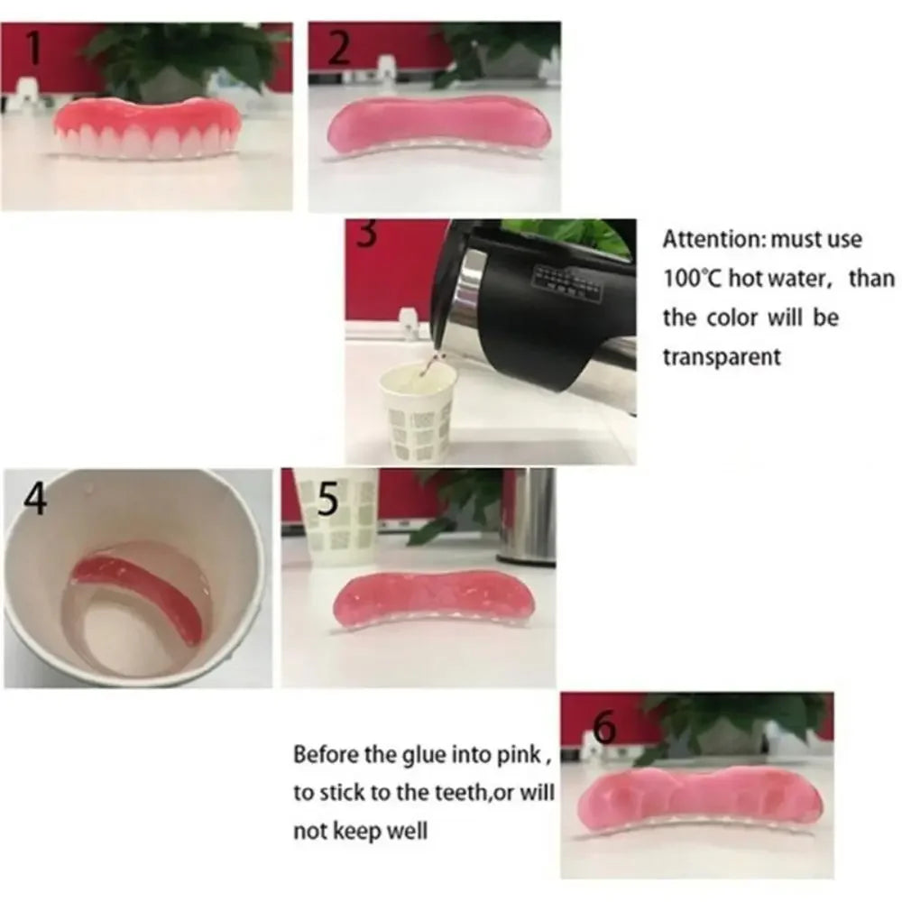 Denture Silicone Liner Kit - Soft Upper & Lower Denture Cushion Set for Easy Dental Care and Comfort