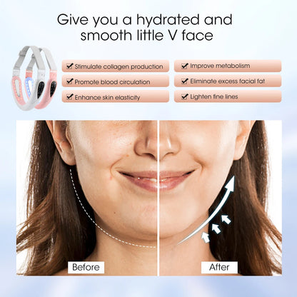 Face Lifting Device with Red Light — V-Face Massager for Double Chin Lift & Skin Rejuvenation, Remote-Controlled Facial Beauty Tool