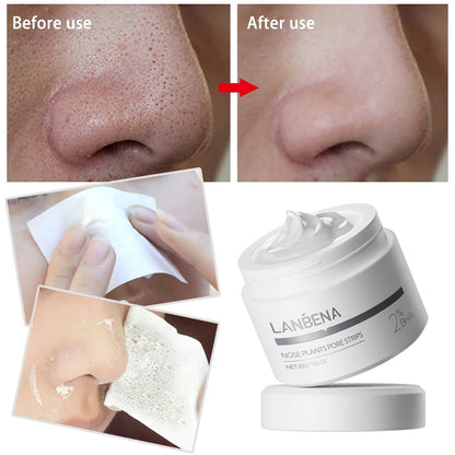 LANBENA Blackhead Remover Nose Pore Strips – Deep Cleansing Oil Control Peel-Off Face Mask (60 Stickers)