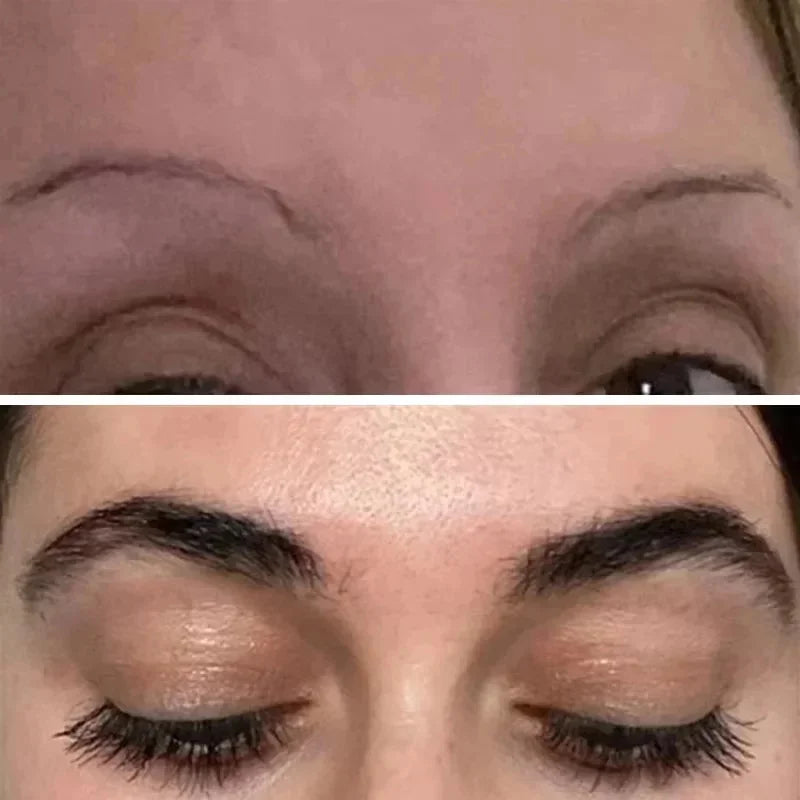 Fast Eyebrow & Eyelash Growth Serum – Hair Loss Prevention, Thicker Fuller Brows & Lashes Enhancer