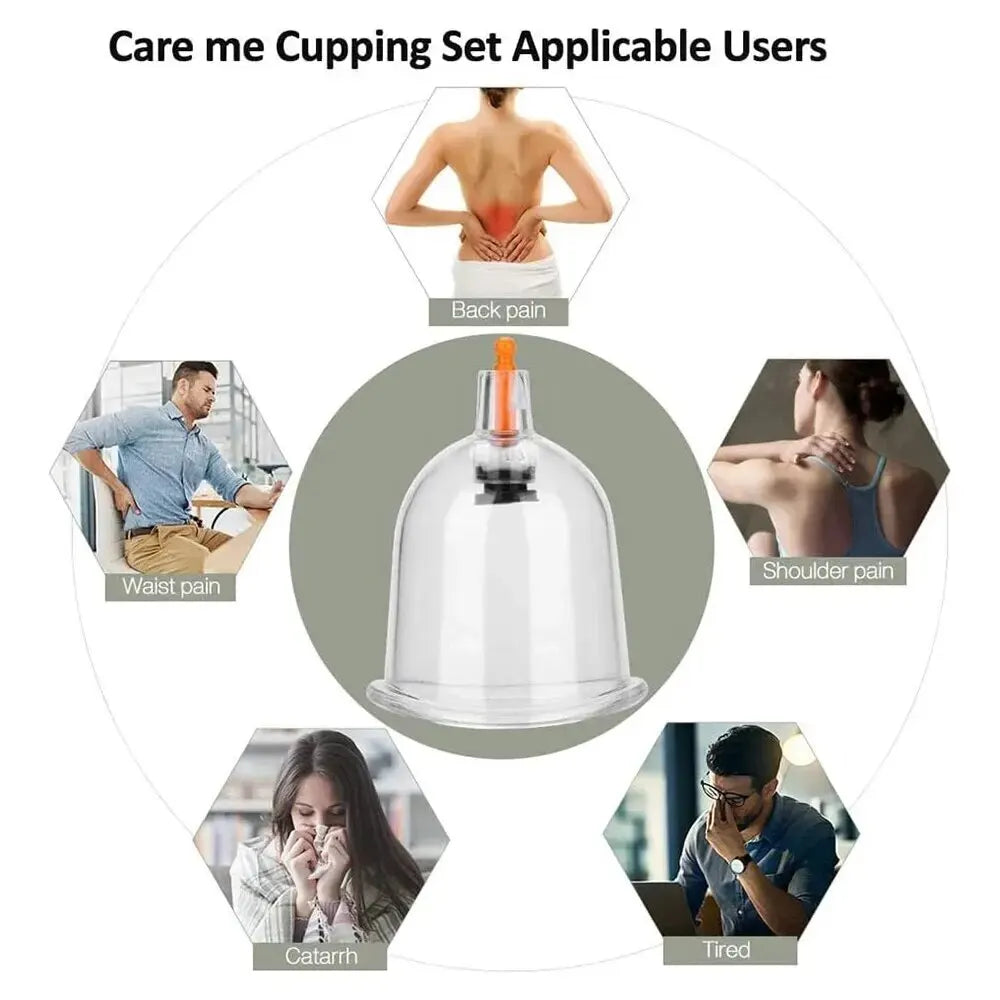 32PCS Professional Vacuum Cupping Set — Body Massager with Suction Cups for Relaxation, Detox & Anti-Cellulite Therapy