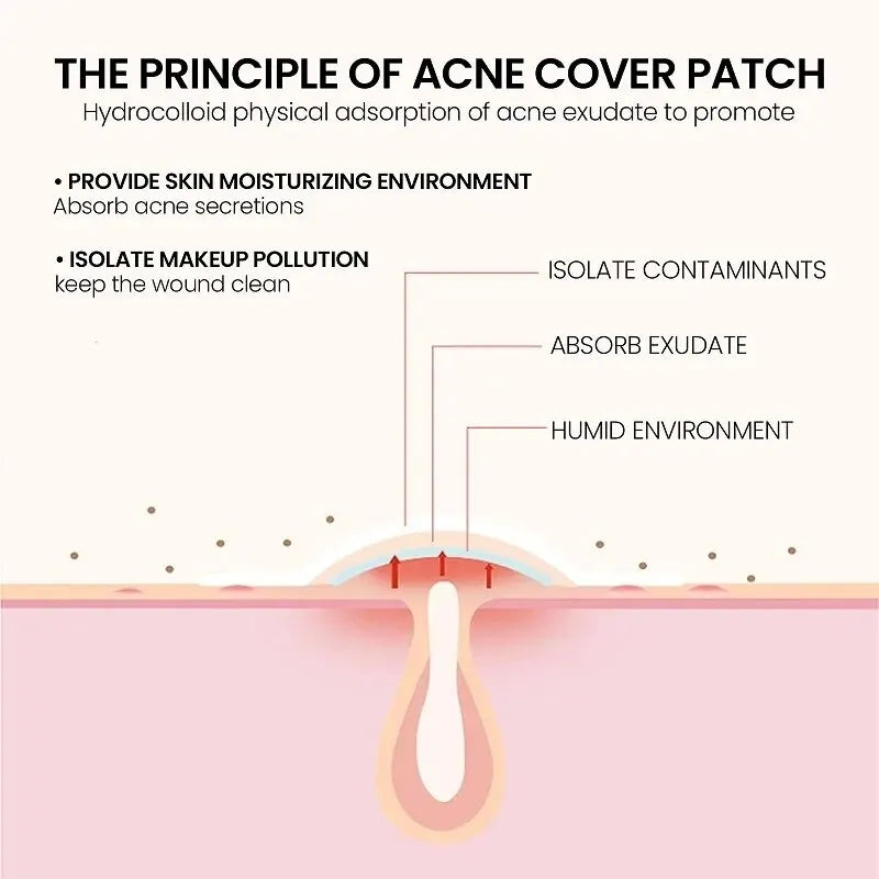 Acne Repair Patch - Facial Skin Care for Blemish & Pimple Marks, Acne Treatment & Pimple Repair Cover