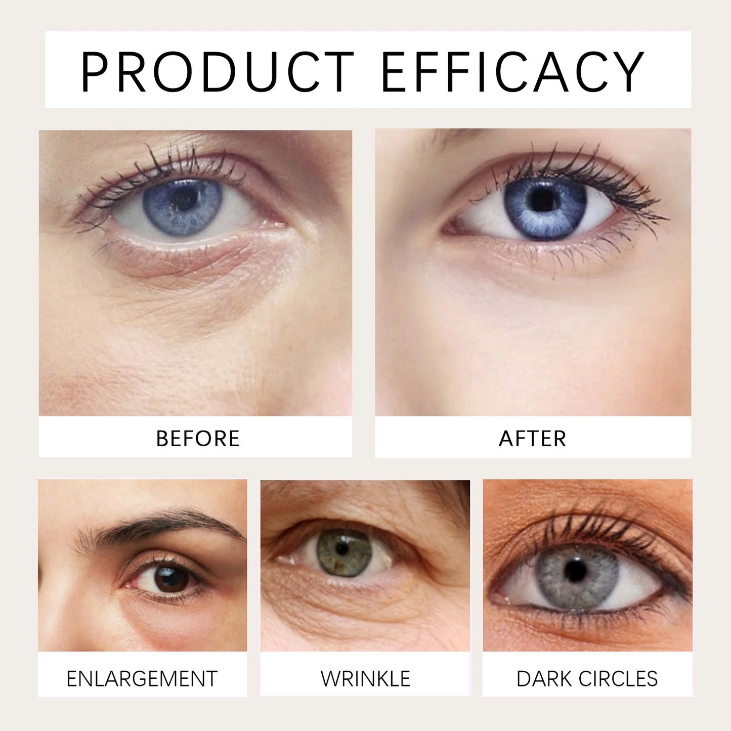 Castor Oil Eye Serum – Anti-Wrinkle, Dark Circle & Puffiness Treatment