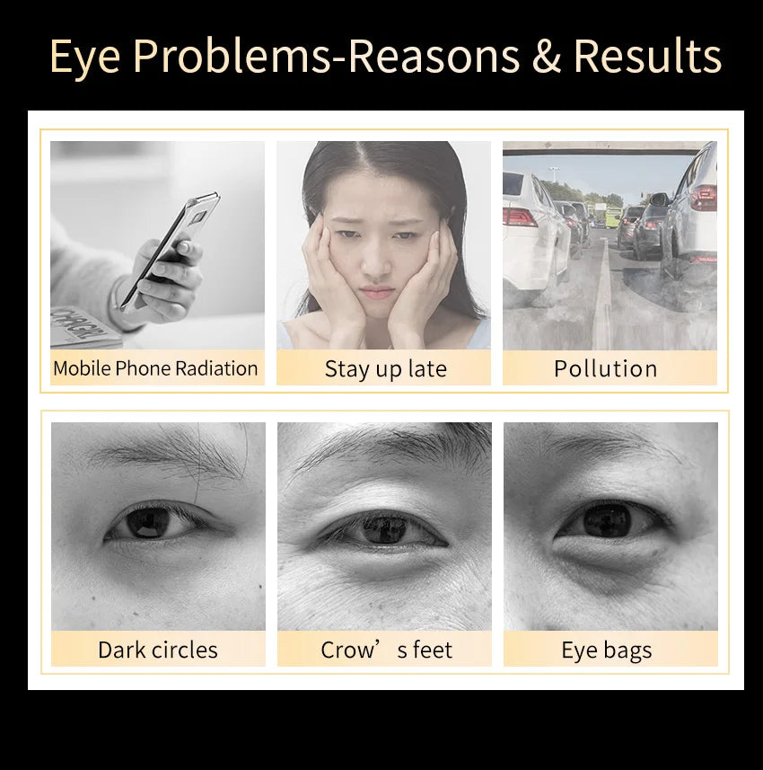 Micro-Needle Hyaluronic Acid Eye Patch – Anti-Wrinkle Moisturizing Eye Mask for Fine Lines Removal