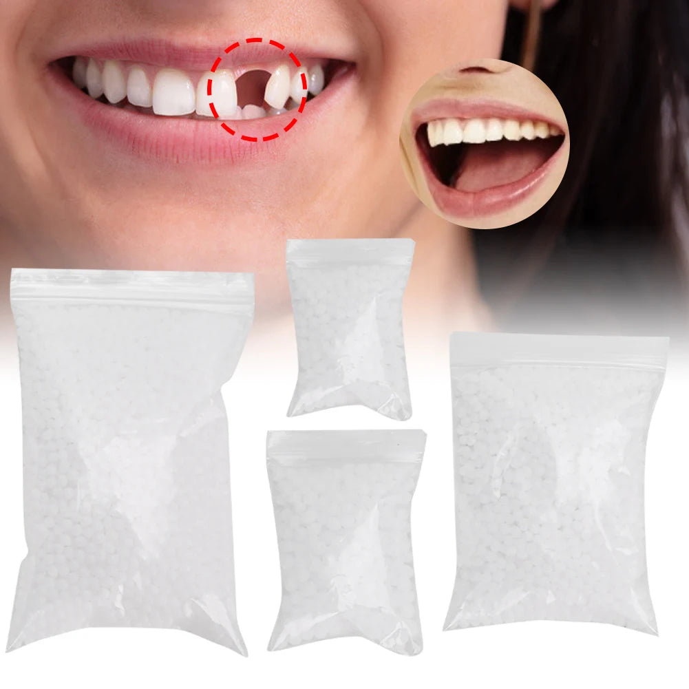 Temporary Tooth Repair Beads – DIY Dental Filling Material for Broken or Missing Teeth