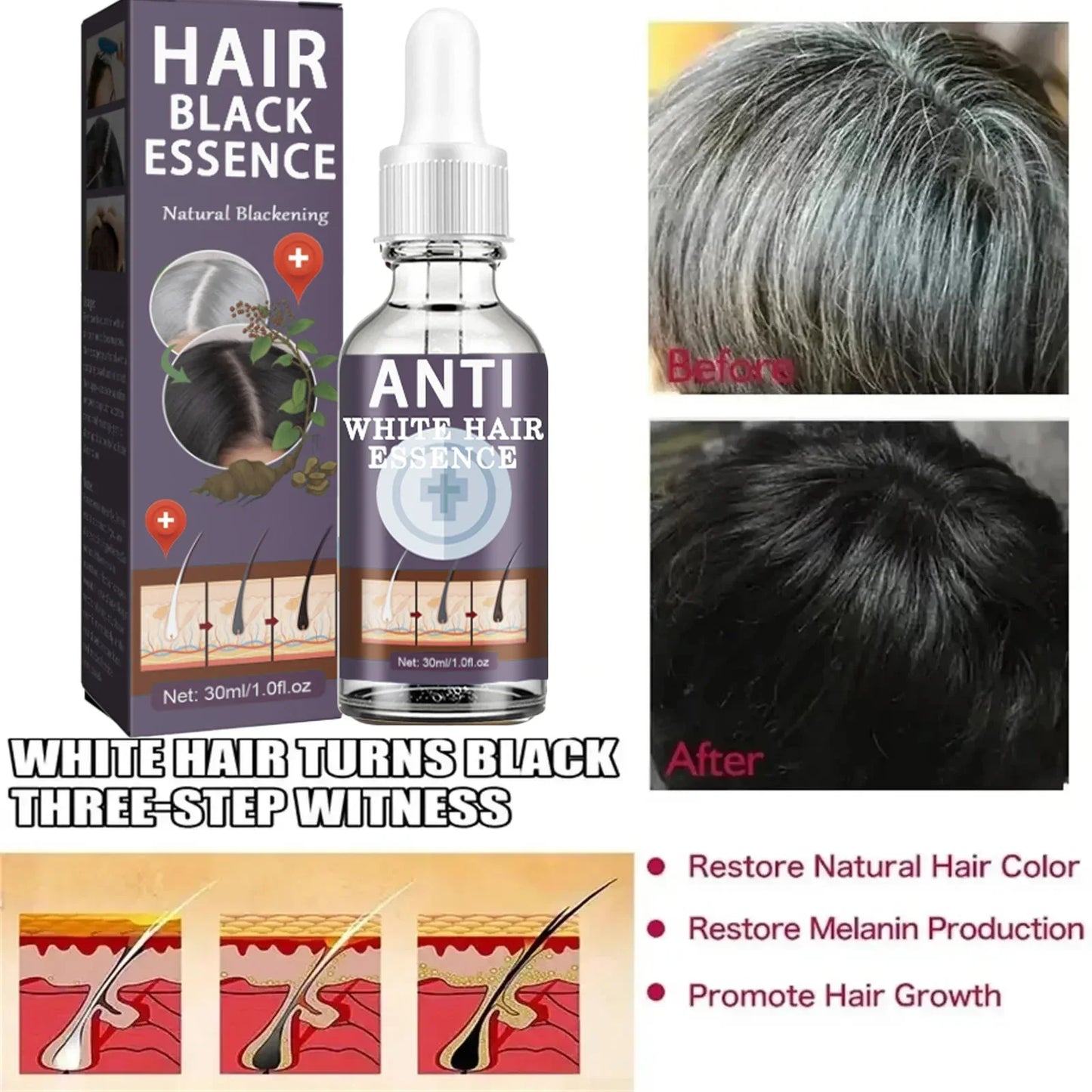 White Hair Remover – Restore Natural Hair Color in 7 Days, Gray Hair Treatment Solution