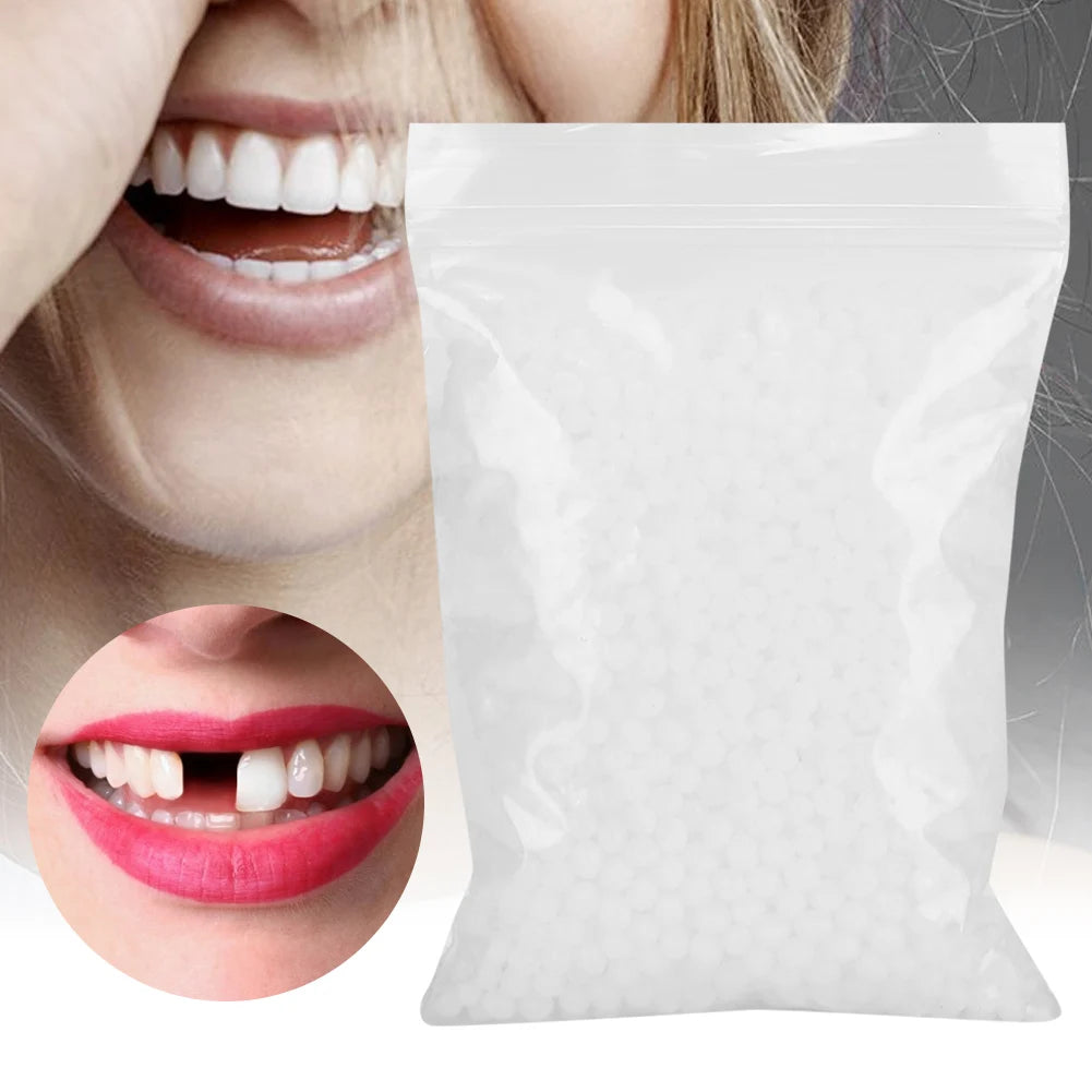 Temporary Tooth Repair Beads – Dental Filling Material for Broken or Missing Teeth