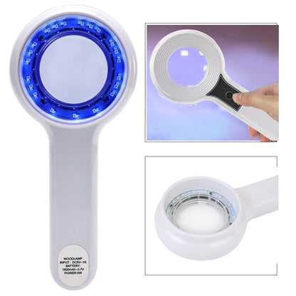 Portable Wood’s Lamp Skin Analyzer – UV Facial Beauty Diagnostic Device for Dermatology Testing & Skin Examination Salon Tool