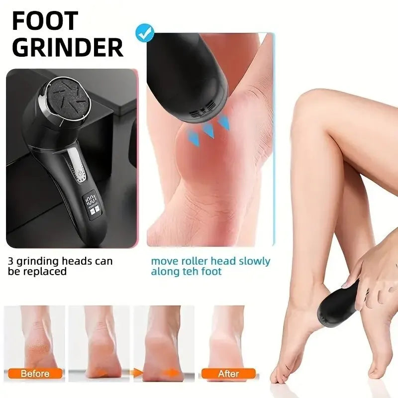 Rechargeable Professional Electric Callus Remover for Feet - Foot Care Kit with 3 Heads, Dander Vacuum Cleaner, and LCD Display